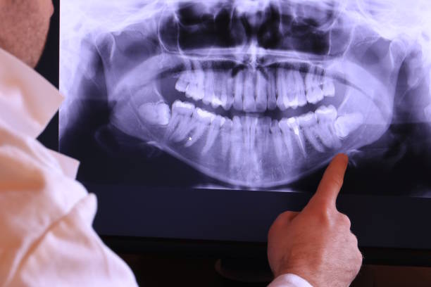 Best Cracked Tooth Emergency Dentist  in Simpson, PA